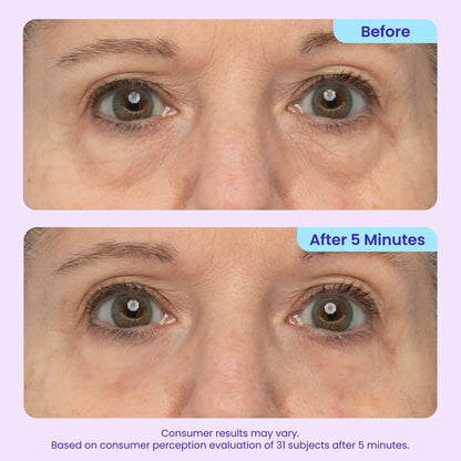 Instant Lift Eye Gel for Puffiness & Wrinkles