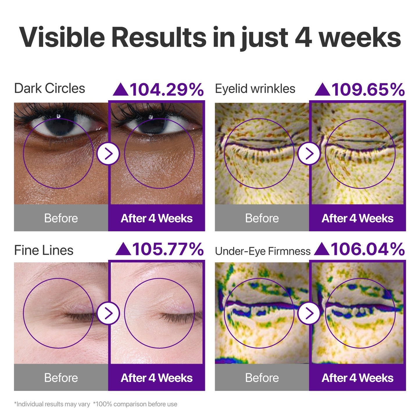 No.9 NAD+ Retinol Volumizing Eye Cream – Targets Dark Circles, Puffiness, Crow’s Feet & Fine Lines with 50 Peptides, 4% Niacinamide and Ceramide, 0.33 fl oz