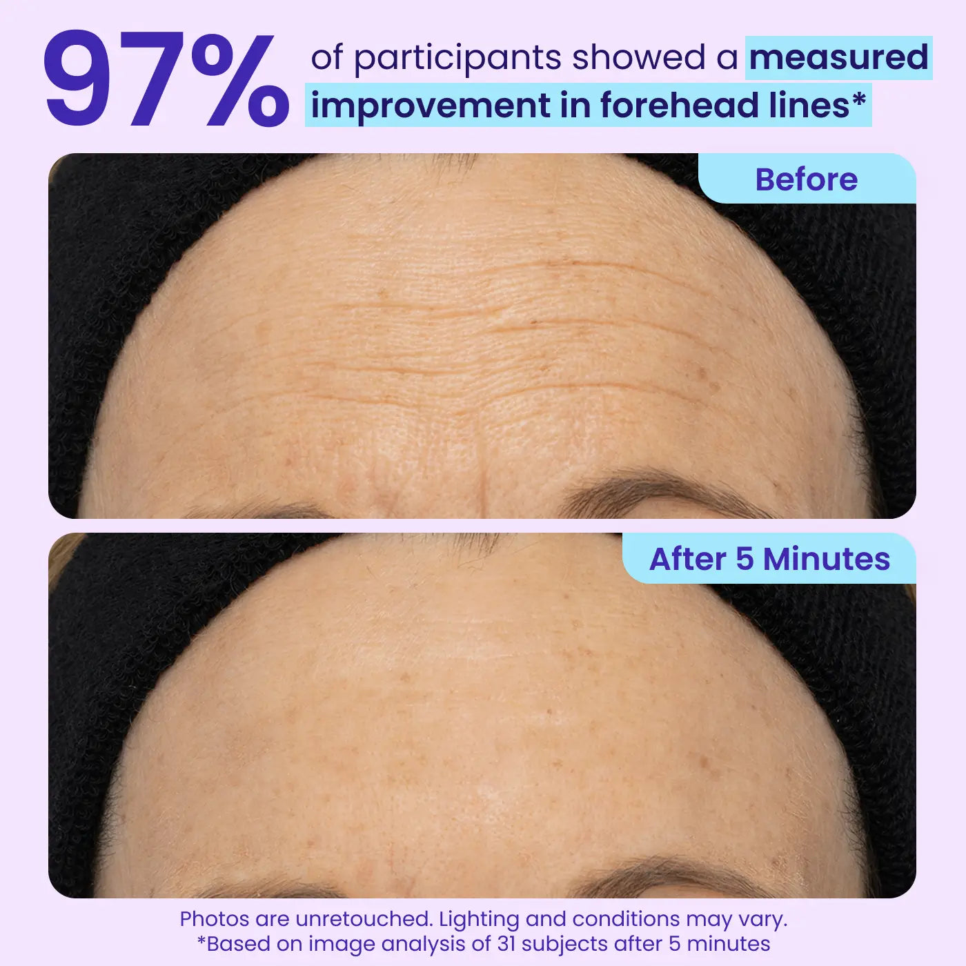 Instant Lift Eye Gel for Puffiness & Wrinkles