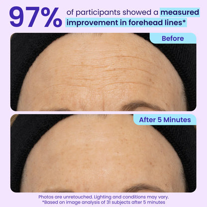 Instant Lift Eye Gel for Puffiness & Wrinkles