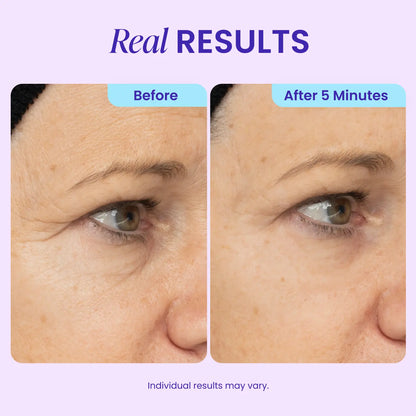 Instant Lift Eye Gel for Puffiness & Wrinkles